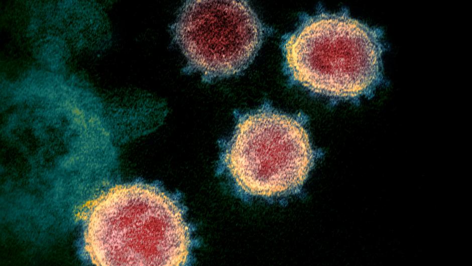 Das Coronavirus SARS-CoV-2 unter mikroskopischer Vergrößerung